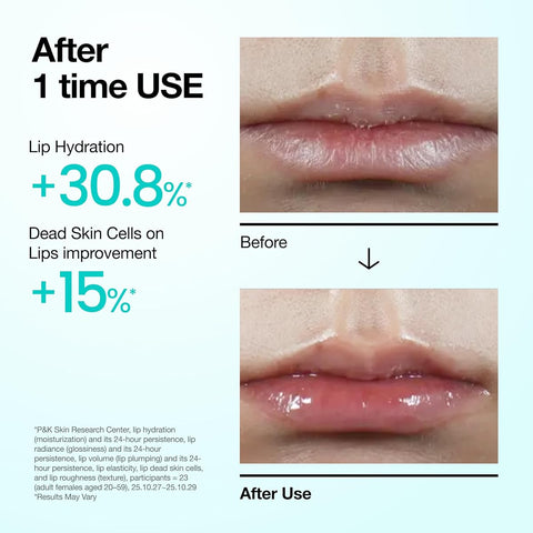 Anua PDRN Lip Serum with Salmon DNA, Hyaluronic Acid & Collagen - 10 ml